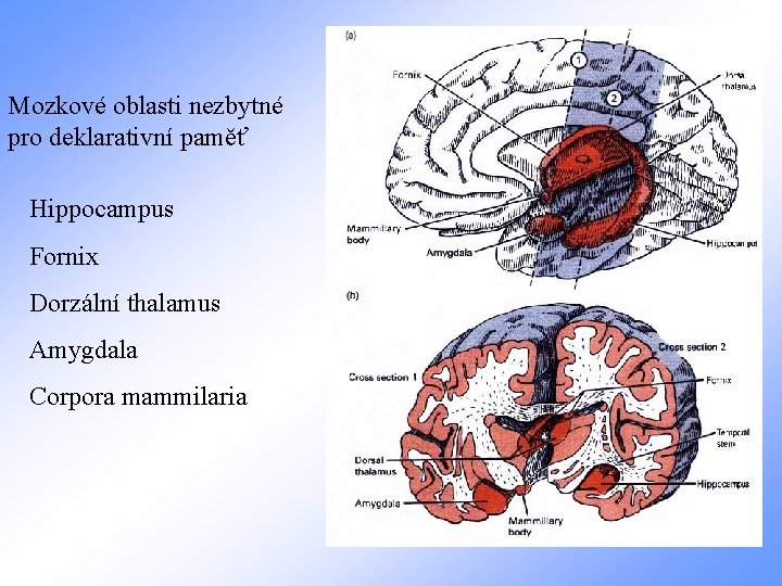 Mozkové oblasti nezbytné pro deklarativní paměť Hippocampus Fornix Dorzální thalamus Amygdala Corpora mammilaria 