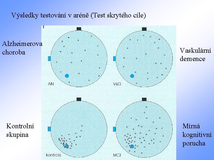 Výsledky testování v aréně (Test skrytého cíle) Alzheimerova choroba Kontrolní skupina Vaskulární demence Mírná