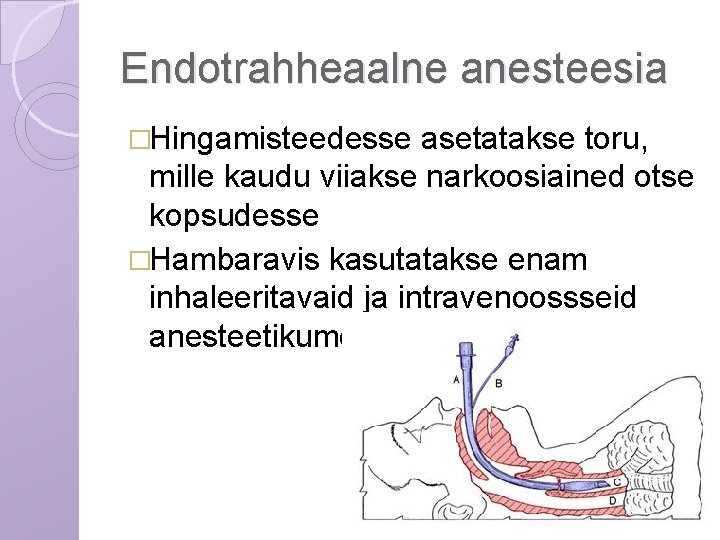 Endotrahheaalne anesteesia �Hingamisteedesse asetatakse toru, mille kaudu viiakse narkoosiained otse kopsudesse �Hambaravis kasutatakse enam
