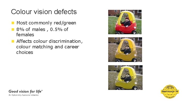 Colour vision defects n Most commonly red/green n 8% of males , 0. 5%