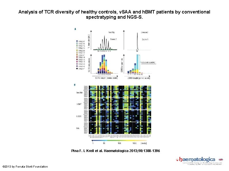 Analysis of TCR diversity of healthy controls, v. SAA and h. BMT patients by