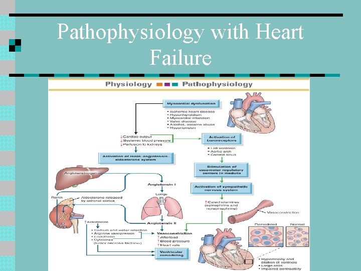 Pathophysiology with Heart Failure 