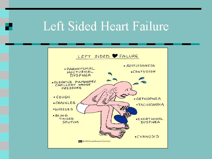 Left Sided Heart Failure 