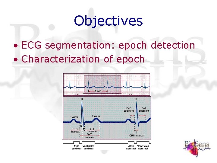 Objectives • ECG segmentation: epoch detection • Characterization of epoch Objectives • ECG segmentation: epoch detection • Characterization of epoch