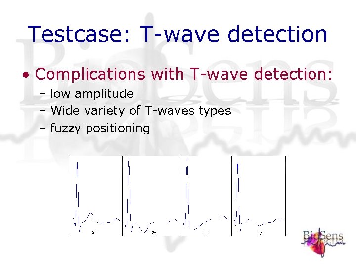 Testcase: T-wave detection • Complications with T-wave detection: – low amplitude – Wide variety Testcase: T-wave detection • Complications with T-wave detection: – low amplitude – Wide variety