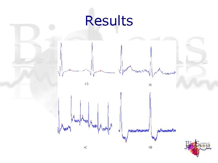 Results Results
