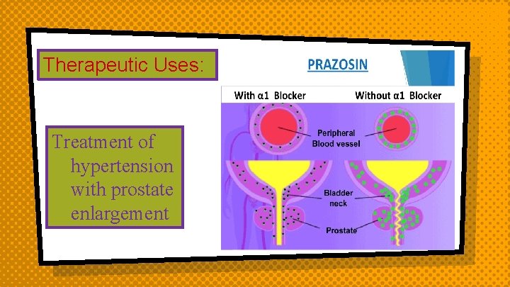 Therapeutic Uses: Treatment of hypertension with prostate enlargement 