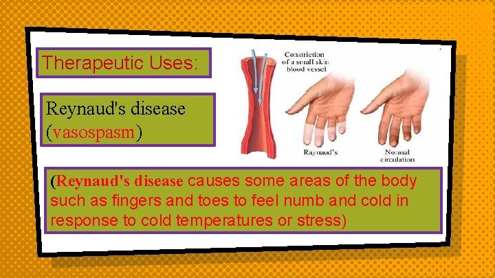 Therapeutic Uses: Reynaud's disease (vasospasm) (Reynaud's disease causes some areas of the body such