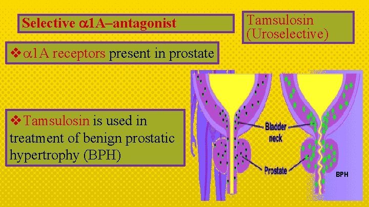 Selective 1 A–antagonist Tamsulosin (Uroselective) v 1 A receptors present in prostate v. Tamsulosin