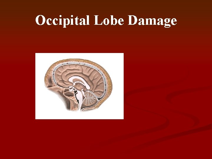 Occipital Lobe Damage 
