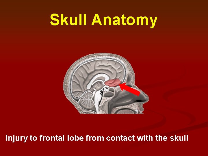 Skull Anatomy Injury to frontal lobe from contact with the skull 