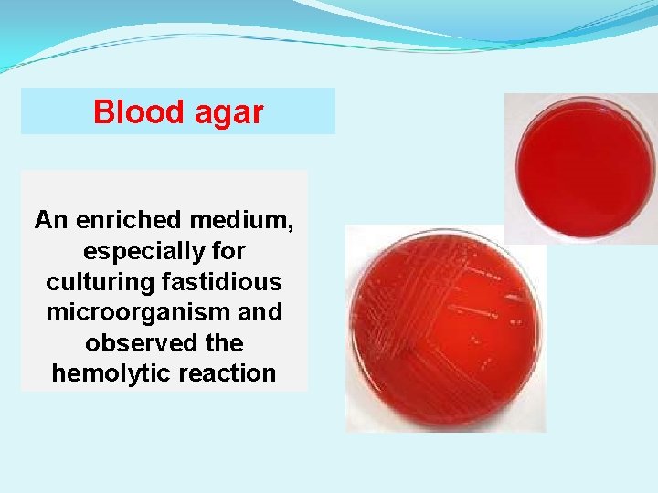 Blood agar An enriched medium, especially for culturing fastidious microorganism and observed the hemolytic