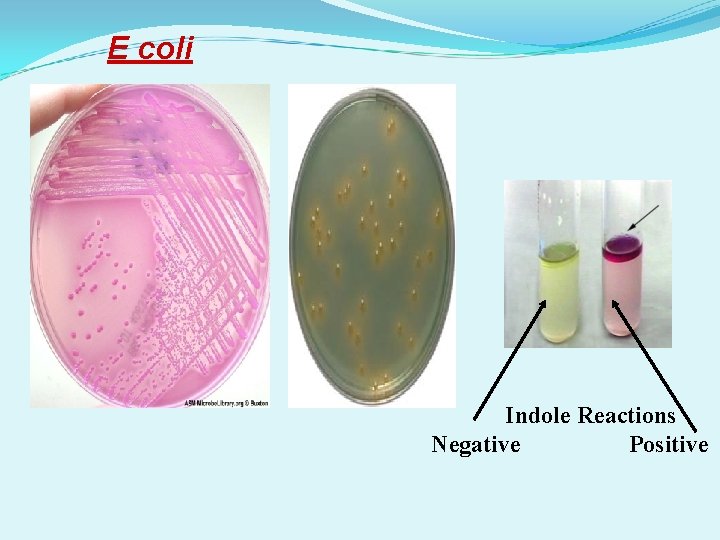 E coli Indole Reactions Negative Positive 
