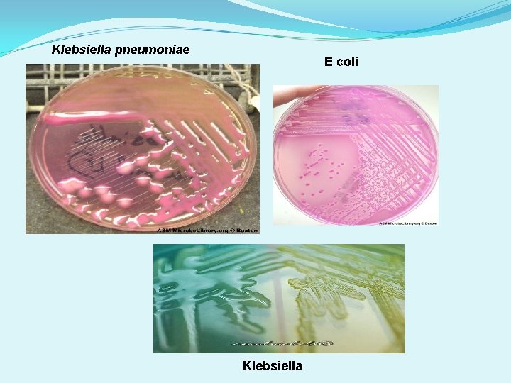 Klebsiella pneumoniae E coli Klebsiella 