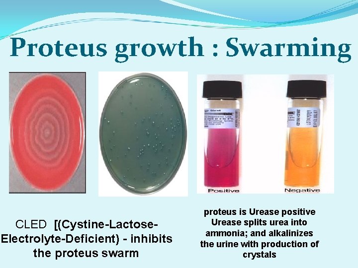 Proteus growth : Swarming CLED [(Cystine-Lactose. Electrolyte-Deficient) - inhibits the proteus swarm proteus is