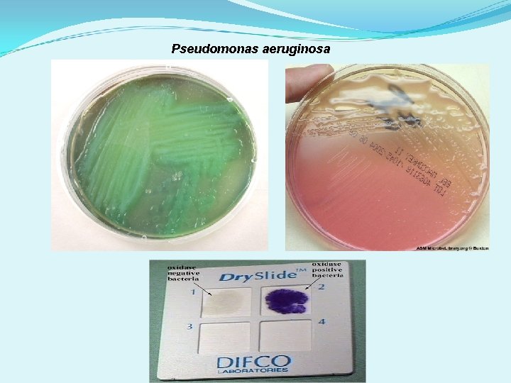 Pseudomonas aeruginosa 