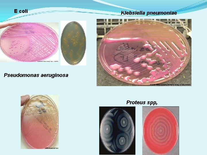 E coli Klebsiella pneumoniae Pseudomonas aeruginosa Proteus spp, 
