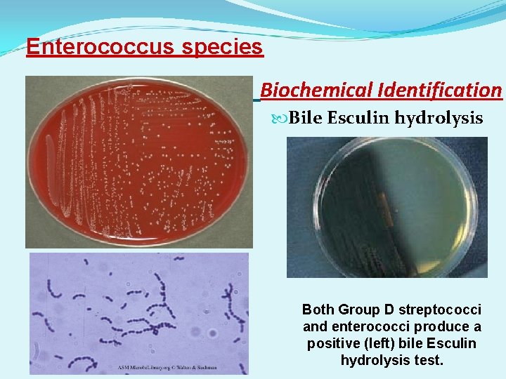 Enterococcus species Biochemical Identification Bile Esculin hydrolysis Both Group D streptococci and enterococci produce
