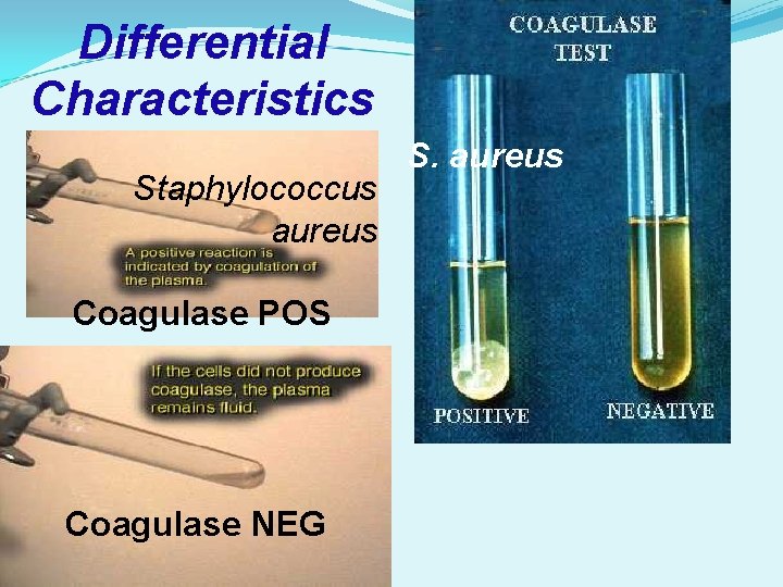 Differential Characteristics Staphylococcus aureus Coagulase POS Coagulase NEG S. aureus 
