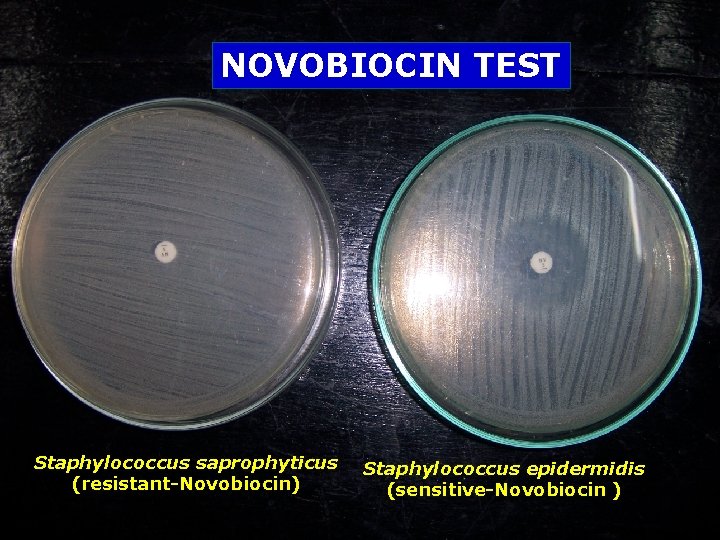 NOVOBIOCIN TEST Staphylococcus saprophyticus (resistant-Novobiocin) Staphylococcus epidermidis (sensitive-Novobiocin ) 