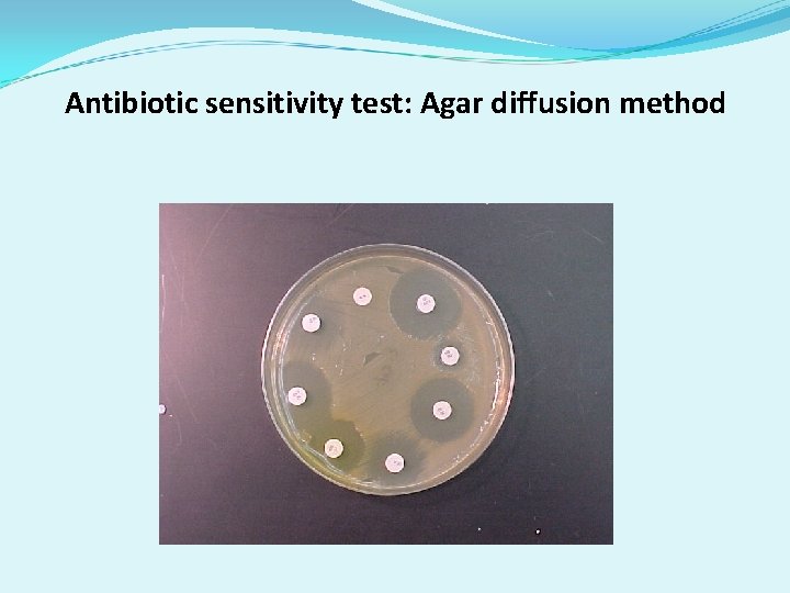 Antibiotic sensitivity test: Agar diffusion method 