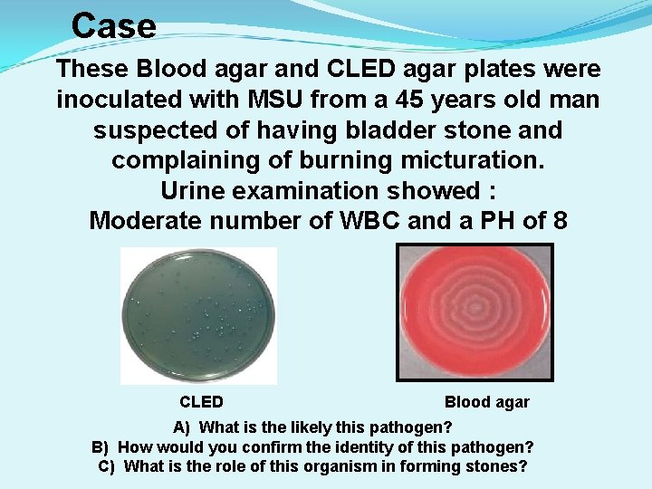 Case These Blood agar and CLED agar plates were inoculated with MSU from a