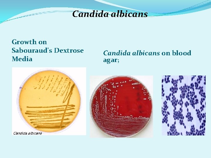 Candida albicans Growth on Sabouraud's Dextrose Media Candida albicans on blood agar; 