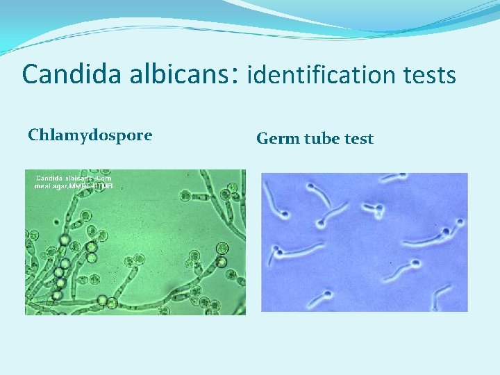 Candida albicans: identification tests Chlamydospore Germ tube test 