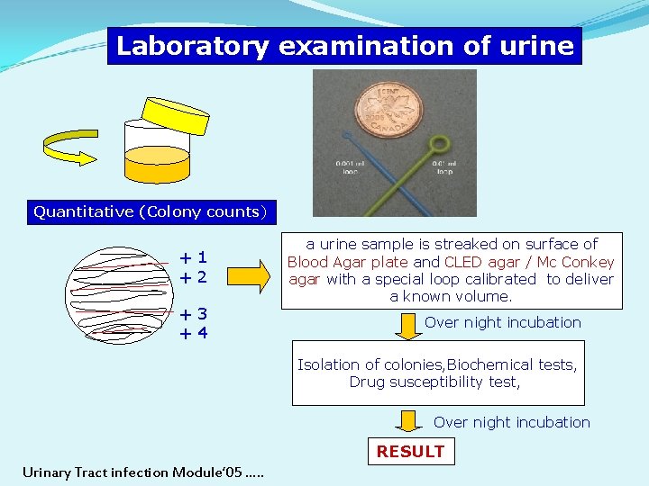 Laboratory examination of urine Quantitative (Colony counts) +1 +2 +3 +4 a urine sample