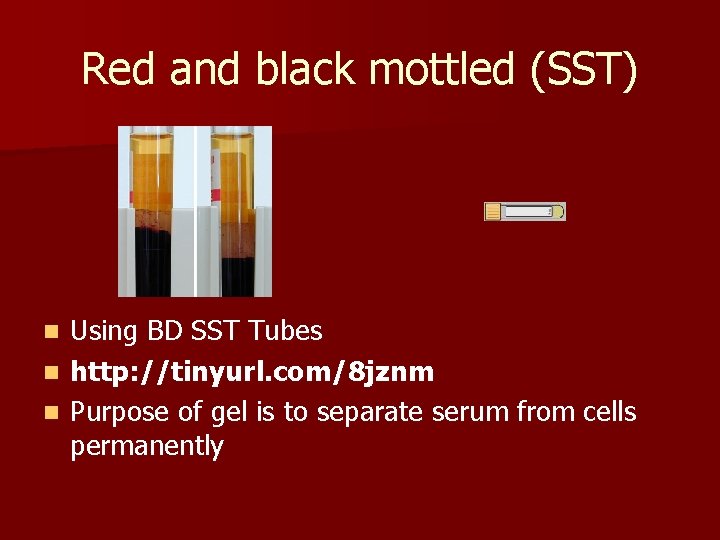 Red and black mottled (SST) Using BD SST Tubes n http: //tinyurl. com/8 jznm