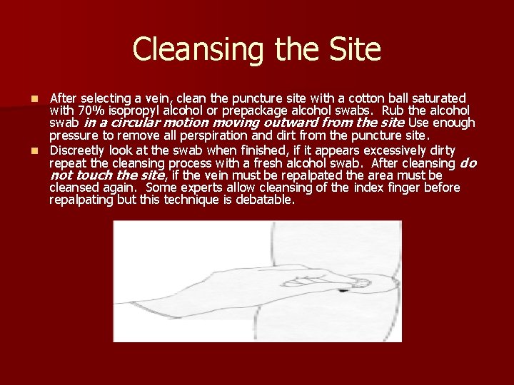 Cleansing the Site After selecting a vein, clean the puncture site with a cotton