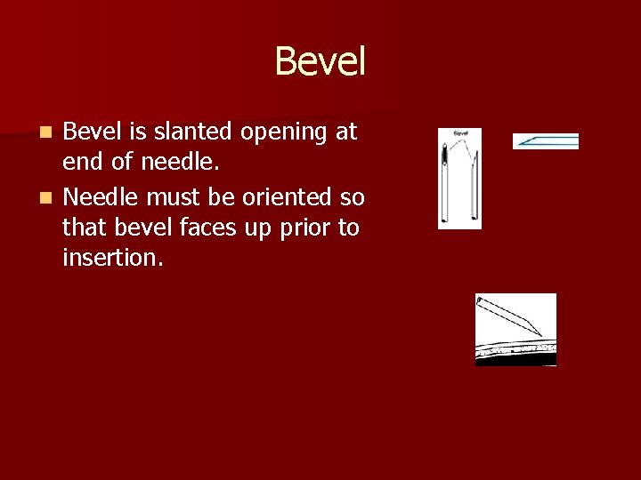 Bevel is slanted opening at end of needle. n Needle must be oriented so