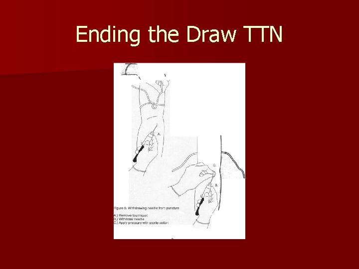 Ending the Draw TTN 