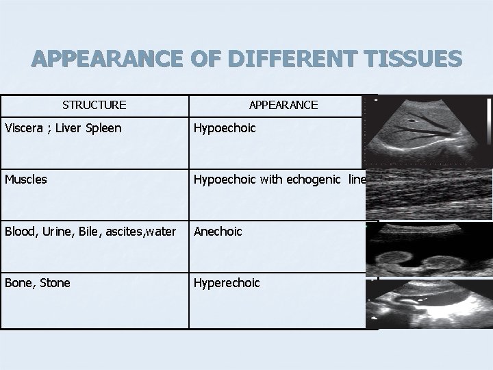 APPEARANCE OF DIFFERENT TISSUES STRUCTURE APPEARANCE Viscera ; Liver Spleen Hypoechoic Muscles Hypoechoic with