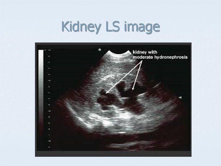 Kidney LS image 