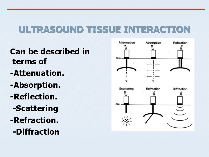 ULTRASOUND TISSUE INTERACTION Can be described in terms of -Attenuation. -Absorption. -Reflection. -Scattering -Refraction.