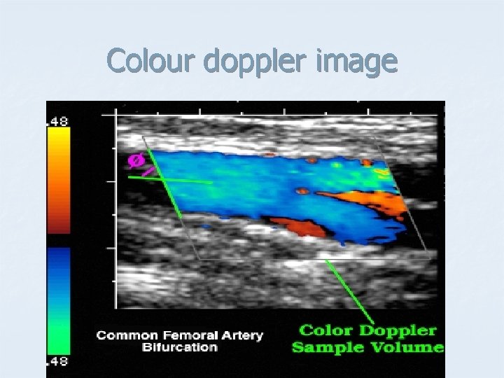 Colour doppler image 