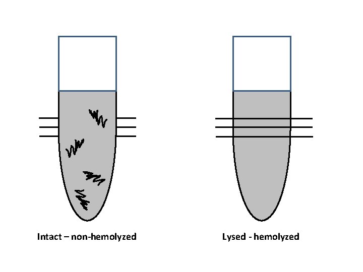 Intact – non-hemolyzed Lysed - hemolyzed 