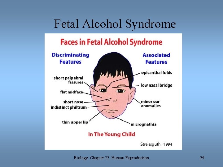 Fetal Alcohol Syndrome Biology Chapter 23 Human Reproduction 24 Fetal Alcohol Syndrome Biology Chapter 23 Human Reproduction 24