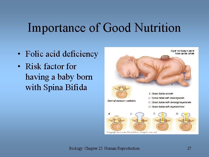 Importance of Good Nutrition • Folic acid deficiency • Risk factor for having a Importance of Good Nutrition • Folic acid deficiency • Risk factor for having a