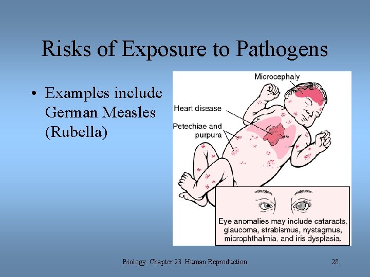 Risks of Exposure to Pathogens • Examples include German Measles (Rubella) Biology Chapter 23 Risks of Exposure to Pathogens • Examples include German Measles (Rubella) Biology Chapter 23