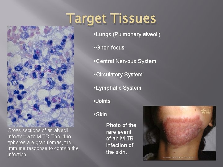 Target Tissues §Lungs (Pulmonary alveoli) §Ghon focus §Central Nervous System §Circulatory System §Lymphatic System