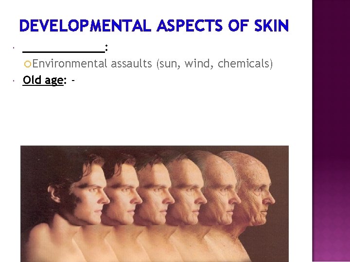 DEVELOPMENTAL ASPECTS OF SKIN ______: Environmental assaults (sun, wind, chemicals) Old age: - 
