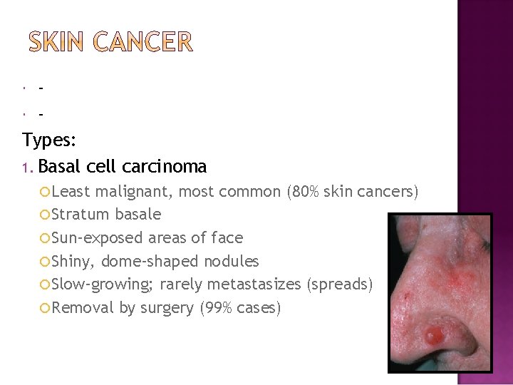  Types: 1. Basal cell carcinoma Least malignant, most common (80% skin cancers) Stratum