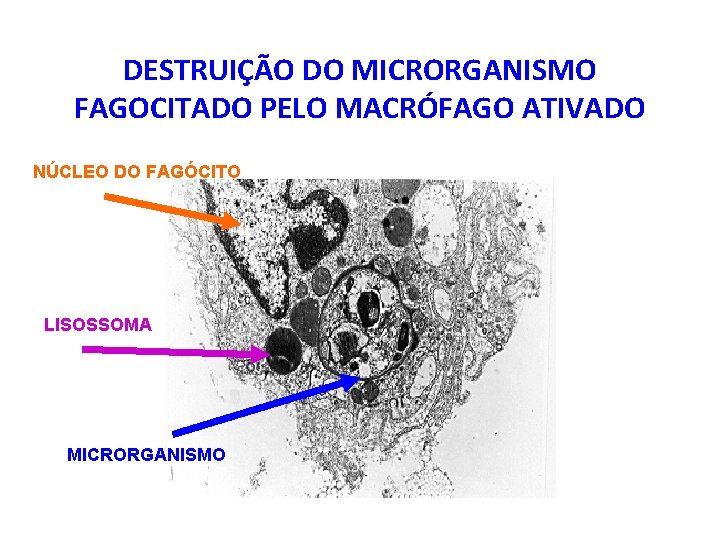 DESTRUIÇÃO DO MICRORGANISMO FAGOCITADO PELO MACRÓFAGO ATIVADO NÚCLEO DO FAGÓCITO LISOSSOMA MICRORGANISMO 