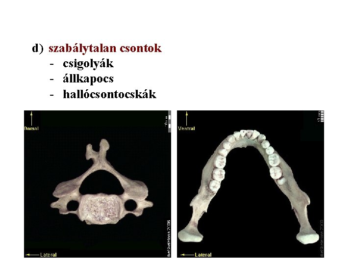 d) szabálytalan csontok - csigolyák - állkapocs - hallócsontocskák 