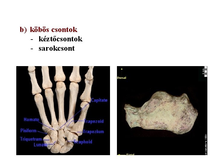 b) köbös csontok - kéztőcsontok - sarokcsont 