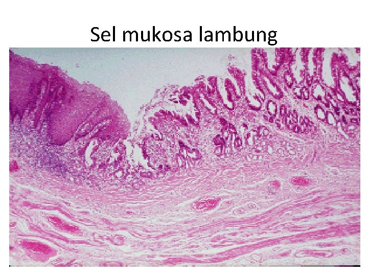 Sel mukosa lambung 