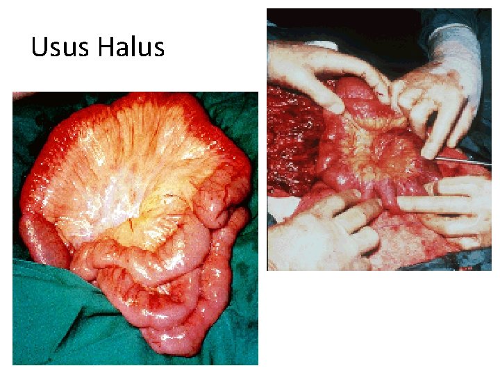 Usus Halus 