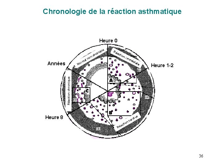 Chronologie de la réaction asthmatique Heure 0 e iqu al orm Années no top